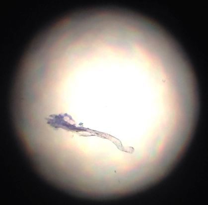 Filamentous fungi were found in-house 